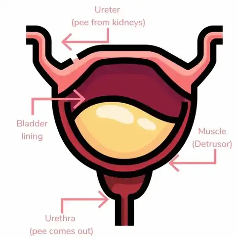 Bladder lining; arrows pointing to muscle around bladder, urethra, ureters and bladder lining 